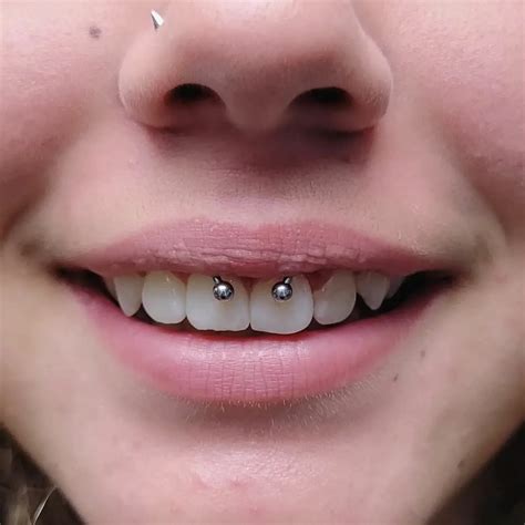 how long for smiley to heal|The Truth About Smiley Piercings